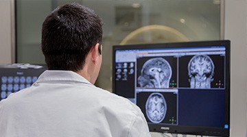 Demuestran un mayor consumo de glucosa cerebral en las primeras etapas del Alzheimer asociado a la activación de los astrocitos