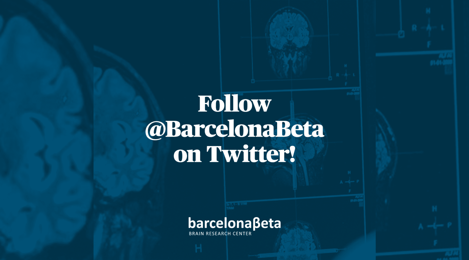 The Barcelonaβeta Brain Research Center (BBRC) launches Twitter profile