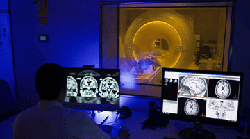 Brain blood flow decreases in asymptomatic stages of Alzheimer's
