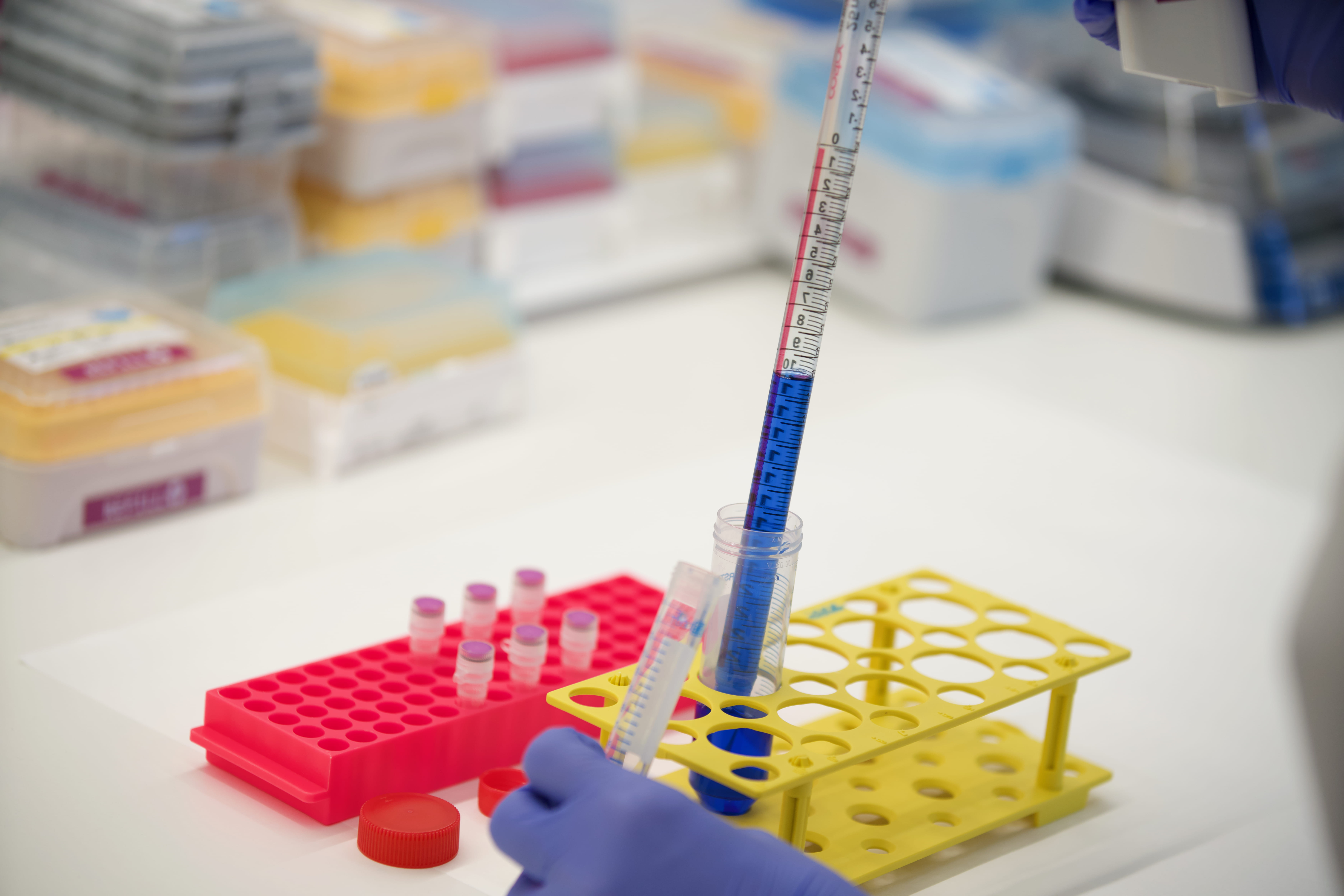 La EMA emite una opinión negativa sobre la autorización de donanemab para el tratamiento del Alzheimer