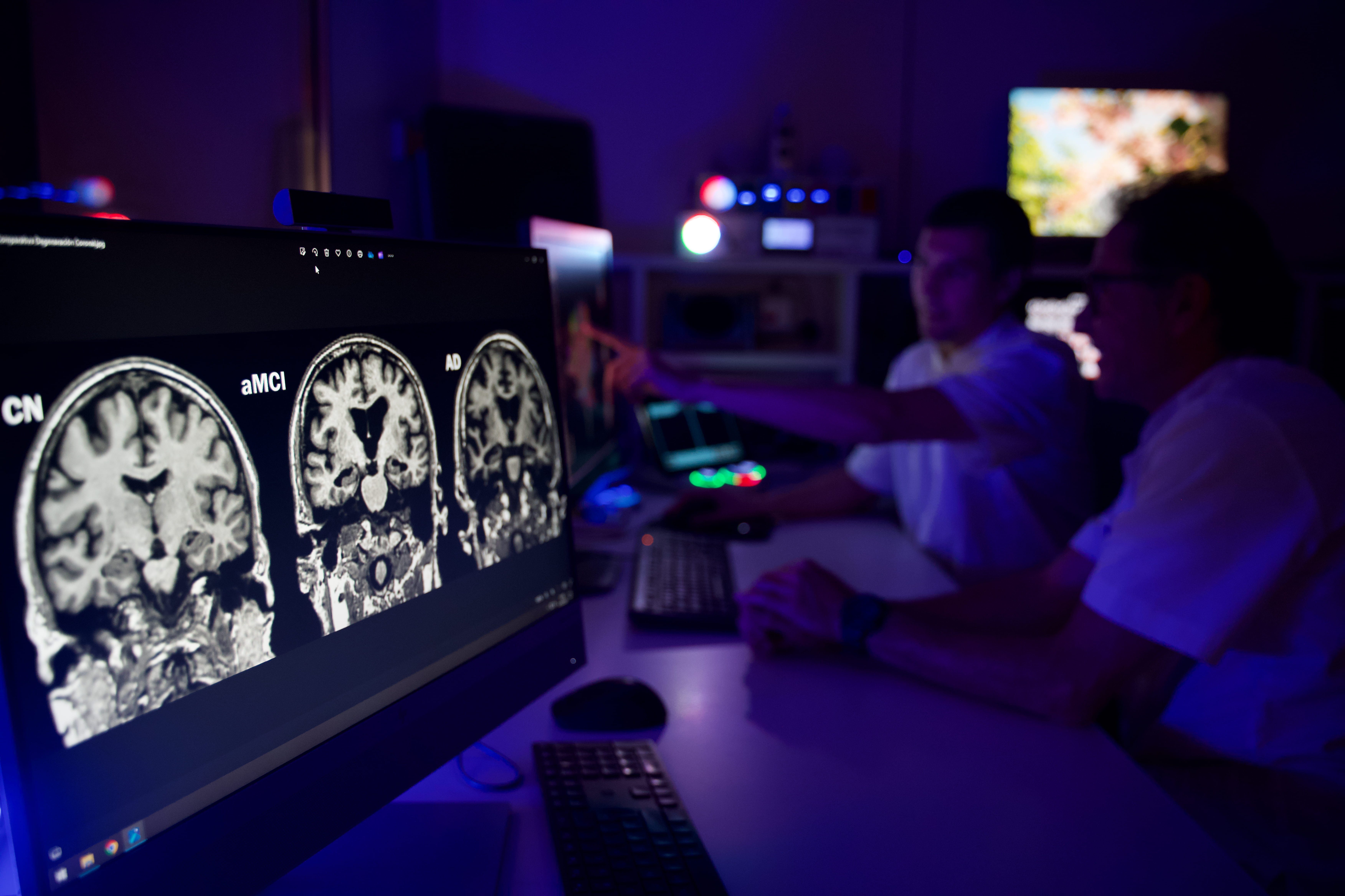The EMA approves marketing authorization for donanemab for early-stage alzheimer’s treatment